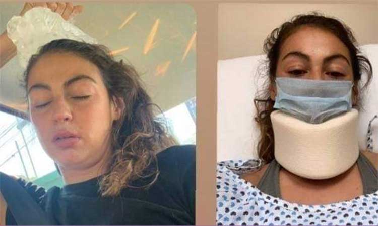 Christina Burkenroad y Mónica Flores sufren accidente automovilístico 